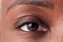 woman's eye area