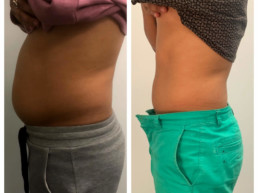 8-slimming-sessions-give-credit-to-@thrivecryostudio