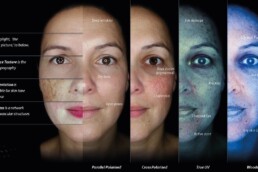 photos of the 4 levels of skin analysis from the Oberserv 320
